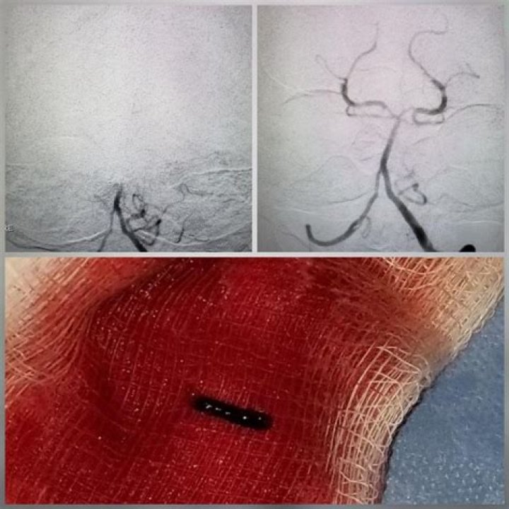 Dr. Aamir Badruddin, MD – Hammond, IN