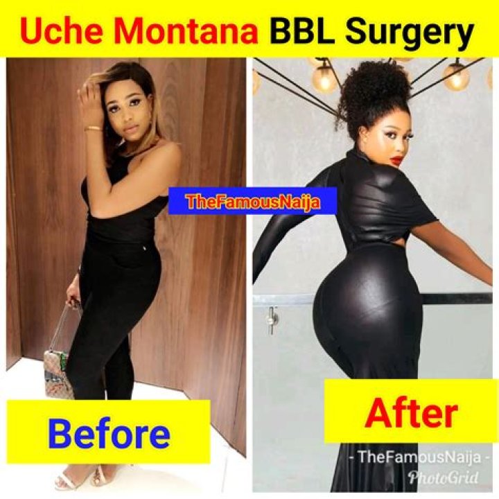 All Facts; FINESSE2TYMES ‘MENTAL BREAKDOWN’ AFTER BBL SURGERY