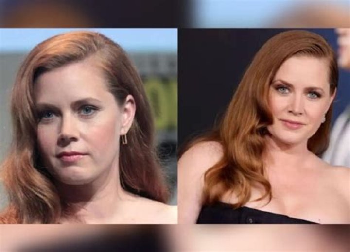 Amy Adams Plastic Surgery Before and After
