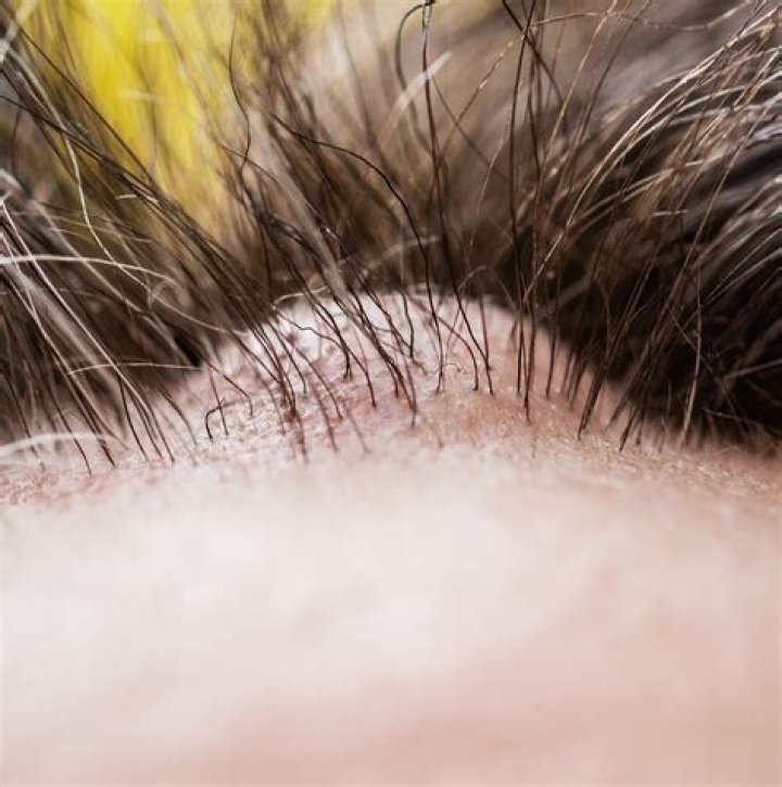 Dr. Ava Khosraviani, MD – Encino, CA