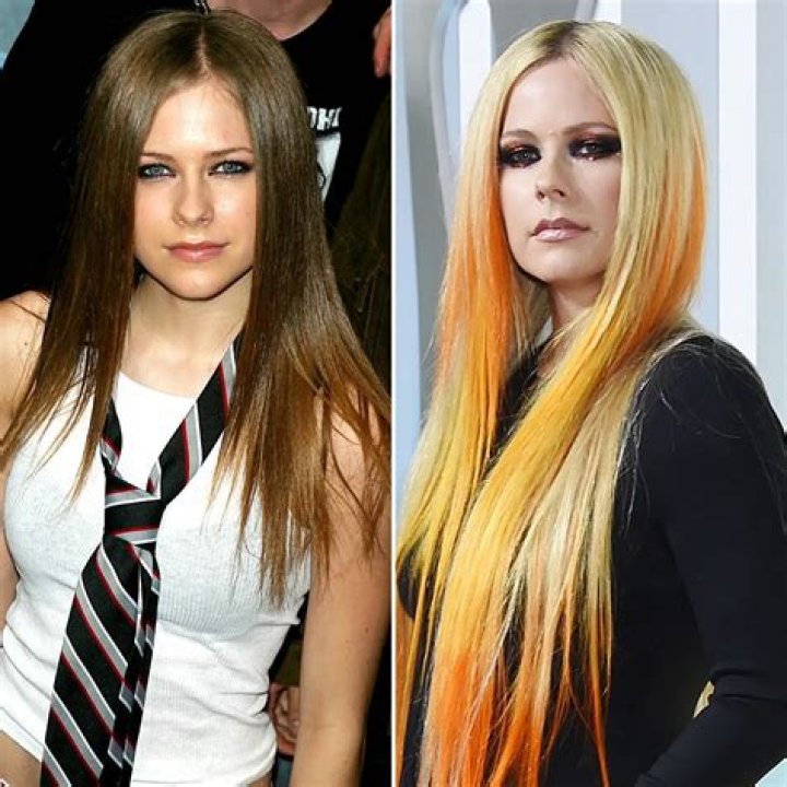 Avril Lavigne Plastic Surgery Before and After
