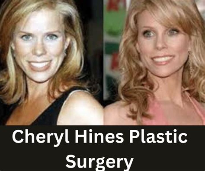 Cheryl Hines Plastic Surgery: From Her Dental Surgery to Her Flawless Appearance Secrets Everything that We Know!