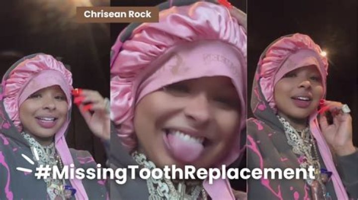 Chrisean Rock missing tooth story explained