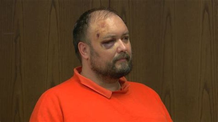 Dr. Douglas Krohn, MD – Piscataway, NJ