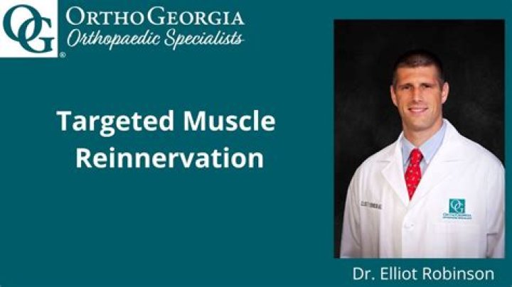 Dr. Elliot Robinson, MD – Macon, GA