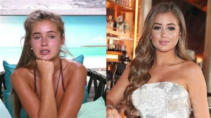 Georgia Steel Plastic Surgery: Georgia's Changing Hairstyle or Various Procedures Credited?