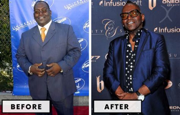 Has Randy Jackson had bypass surgery? Has Randy Jackson lost weight?