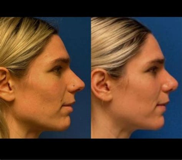 Dr. Hollin Calloway, MD – Hoboken, NJ