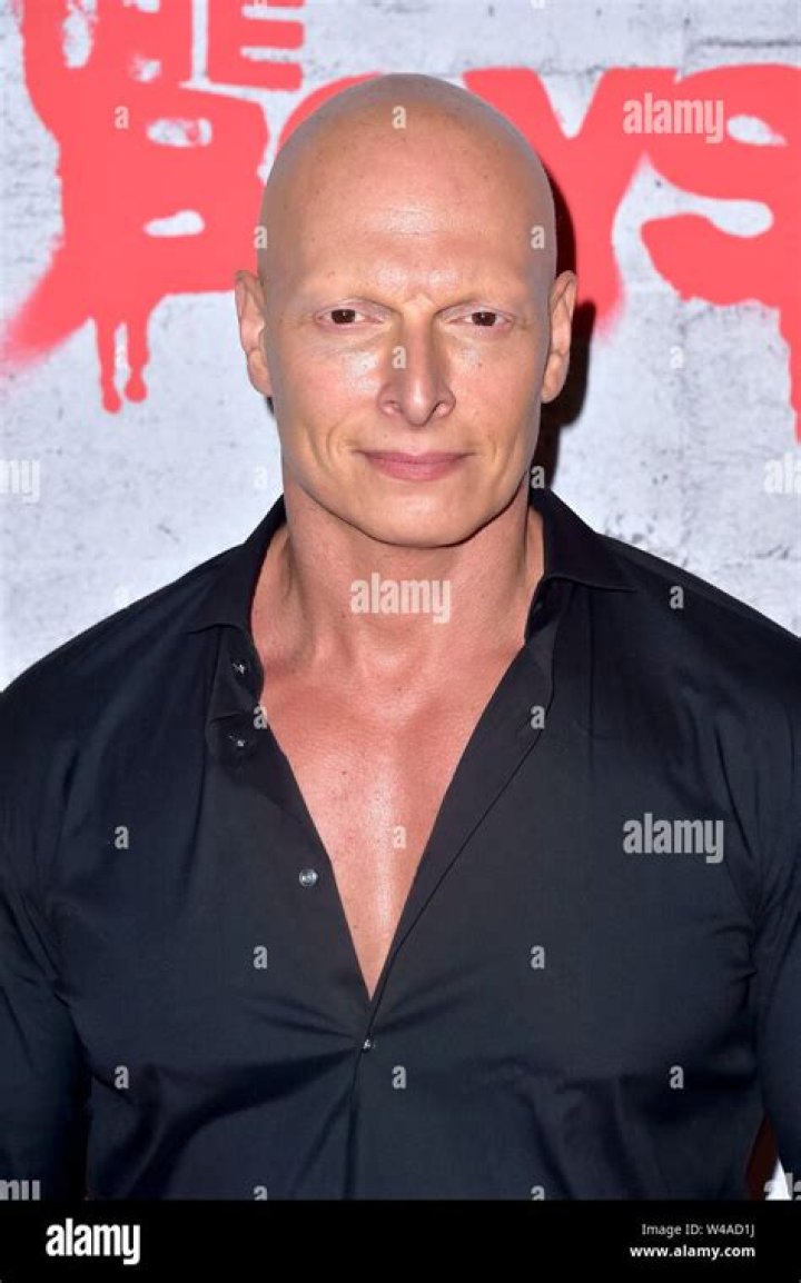 Is Joseph Gatt actually albino?