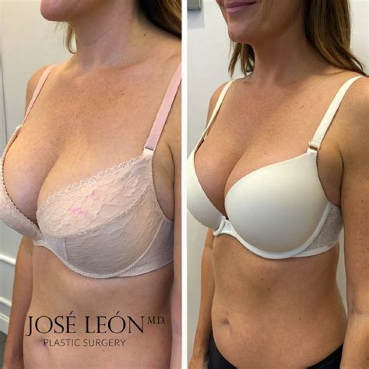 Dr. Jose Leon Jr., MD – Bay Shore, NY