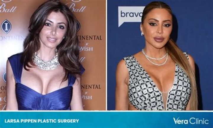 Larsa Pippen Before and After Surgery Pictures