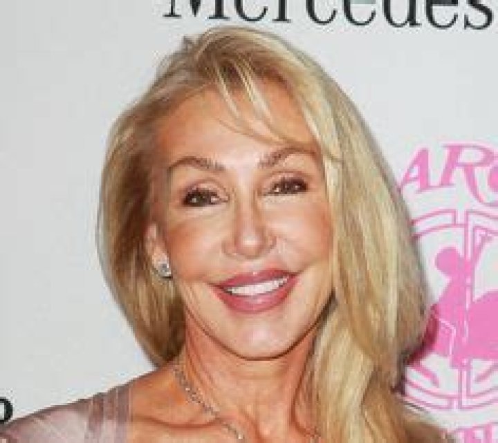 Linda Thompson Facelift Plastic Surgery Before and After