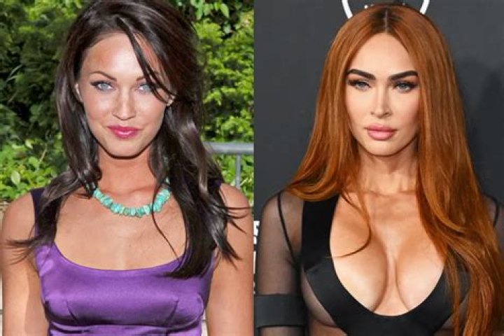 Megan Fox Plastic Surgery: How Her Cosmetic Procedures Transformed Her Appearance