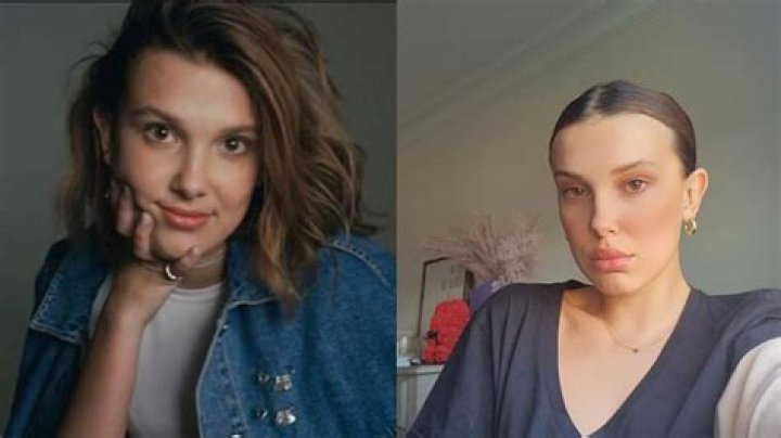 Millie Bobby Brown before and after plastic surgery
