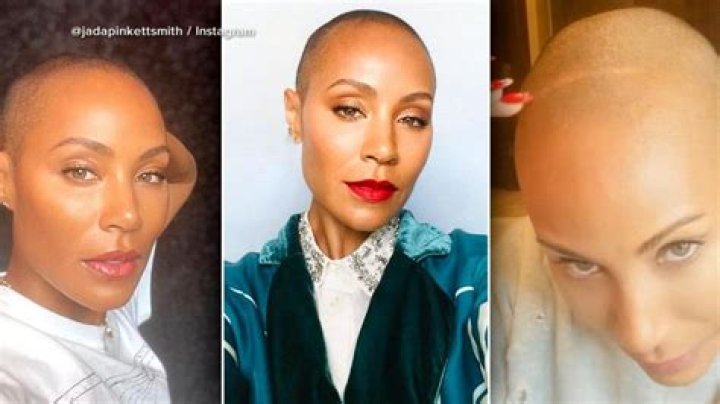 Jada Pinkett Smith’s Hair Loss is Caused by Alopecia — Celebwell