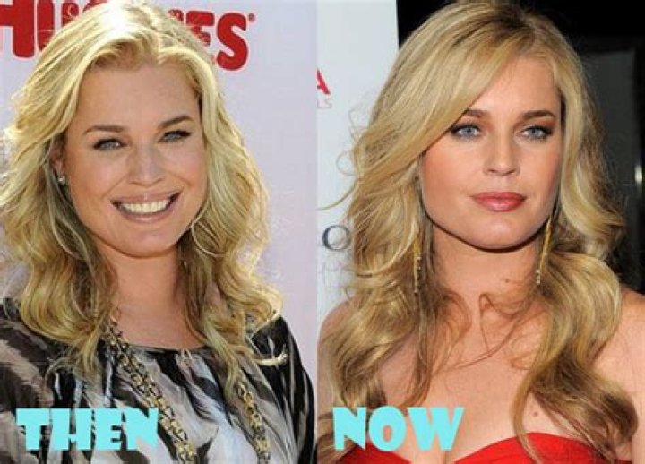 Rebecca Romijn Plastic Surgery: Rebecca's Perceptions and Actions with Plastic Surgery!