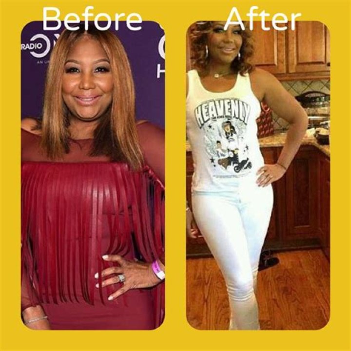 Traci Braxton Weight Loss After Cervical Cancer Diagnosis, Before and After Surgery Pictures