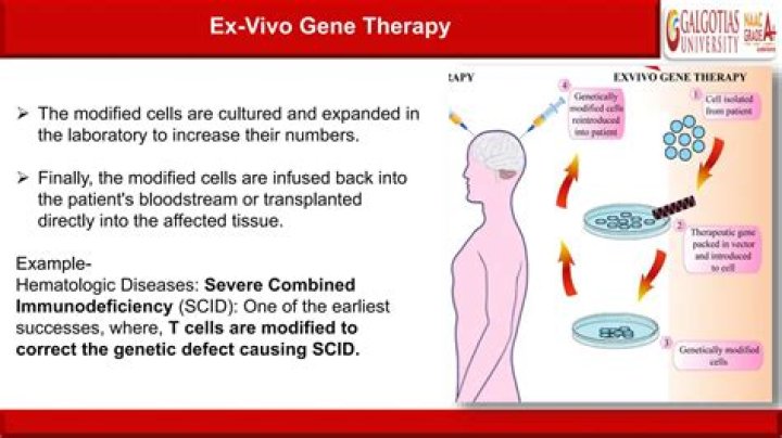 What is the Difference Between Ex Vivo and In Vivo Gene Therapy