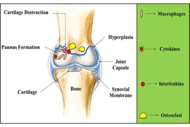 Who Is Stephen Panus? Obituary And Car Accident Details Of His Son Jake Panus
