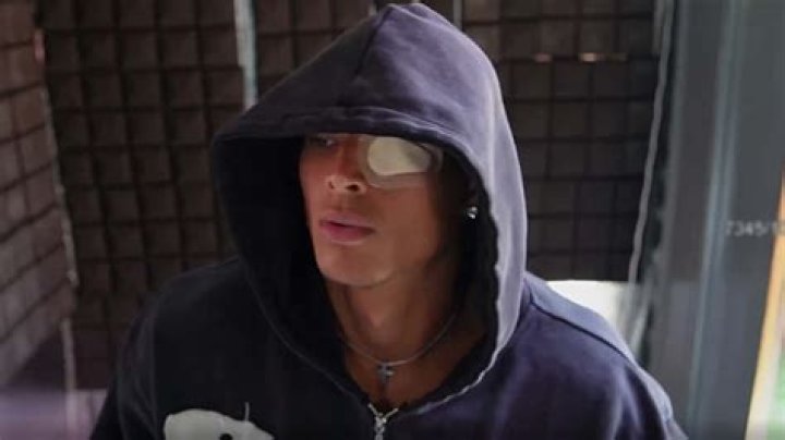 Why did Marlon Brando wear a prosthetic?