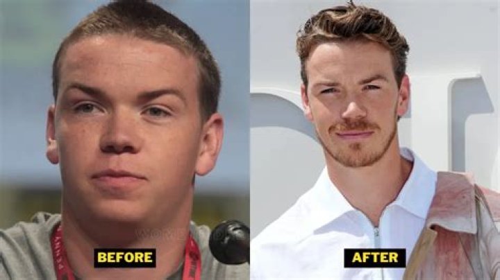 Will Poulter Plastic Surgery: Poutler's Strategies of Achieving Naturally or Artificially?